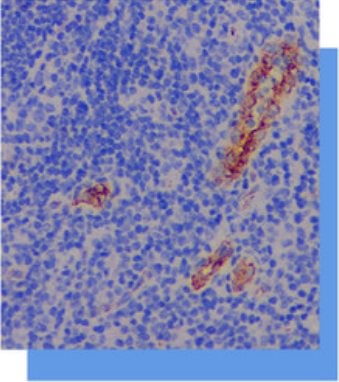 Factor VIII受体抗体试剂