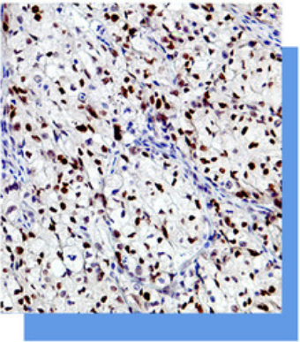 细胞周期蛋白E抗体试剂
