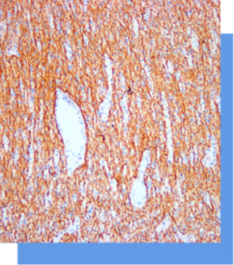 Neurofilament抗体试剂
