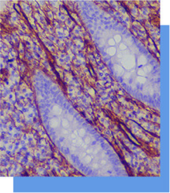 Caldesmon抗体试剂