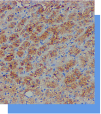 Inhibin, alpha抗体试剂