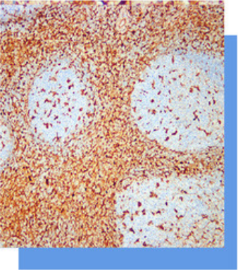 Annexin A1抗体试剂