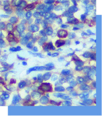 Alpha-1-Fetoprotein抗体试剂