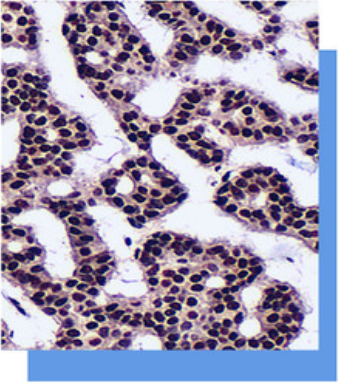胸苷酸合酶（5-FU耐药标记）抗体试剂