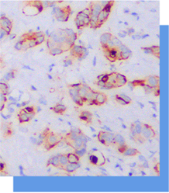 GCDFP-15抗体试剂