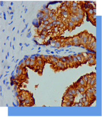 细胞角蛋白（低分子量）抗体试剂