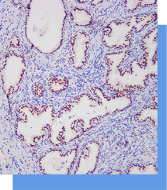 雄激素受体（AR）抗体试剂