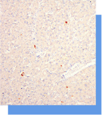 乙型肝炎核心抗原(HBcAg)抗体试剂