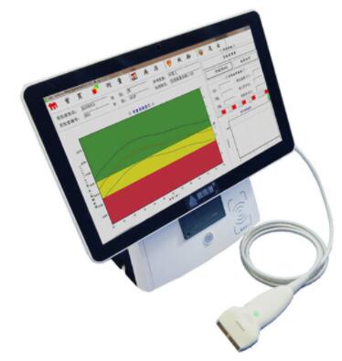 康荣信便携式超声骨密度仪UBS-3000mini