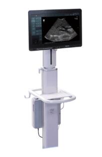 彩色超声诊断设备汎用超音波两像趁断装置ARIETTA Precision