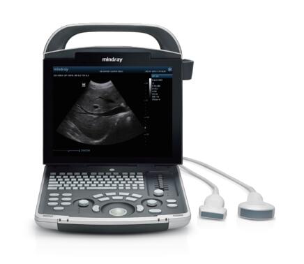 迈瑞 全数字便携式超声诊断系统DP-30