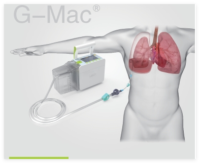 乐信 胸腔引流监控系统 G-Mac