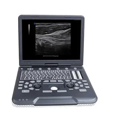 全数字彩色多普勒超声诊断系统Apogee 1000