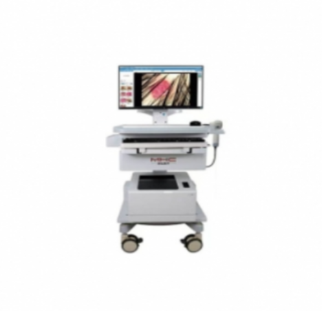 医用电子皮肤镜影像系统ch-dsis-1000