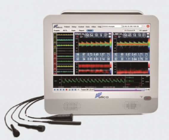 超声经颅多普勒血流分析仪3d1